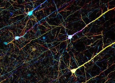 Confocal microscopy of the cortex in a mouse's brain