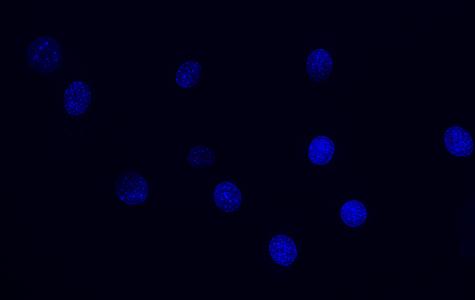 Glioblastoma Cells Responding to Treatment!