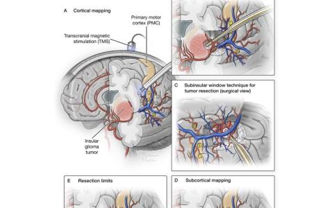 Cover of August 2026 Issue Journal of Neurosurgery