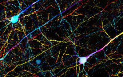 Confocal microscopy showing neurons in mouse cortex