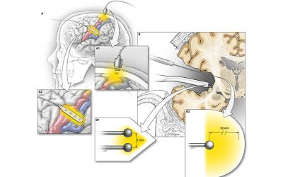 Illustration depicting how triple motor mapping works.